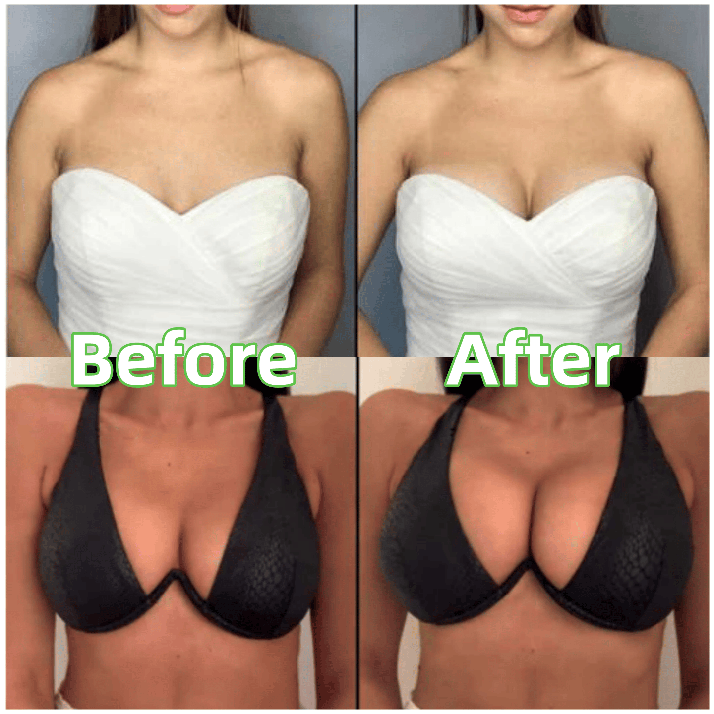 💕LAST DAY SALE ONLY ￡7.99!!💕OUFALI Lift Inserts for Bras – Lightly Padded, Double-Sided Adhesive👙 Reusable, Washable • Natural Lift • Seamless Under Clothing ✨