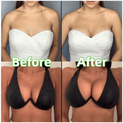 💕LAST DAY SALE ONLY ￡7.99!!💕OUFALI Lift Inserts for Bras – Lightly Padded, Double-Sided Adhesive👙 Reusable, Washable • Natural Lift • Seamless Under Clothing ✨