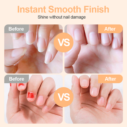 💗LAST DAY SALE 50% OFF⚡🌟2-in-1 Safe Electric Nail Clipper